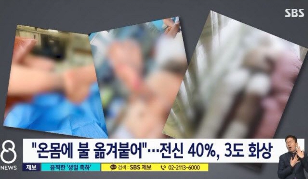  현실판 '더글로리'..생일날 휘발유 뿌리고 폭죽 터뜨려