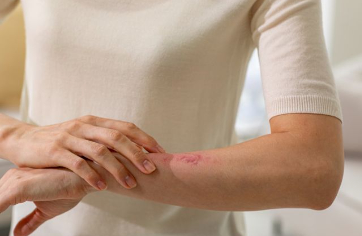  '바늘로 콕콕' 중장년 여성 62%가 겪는 이것은?