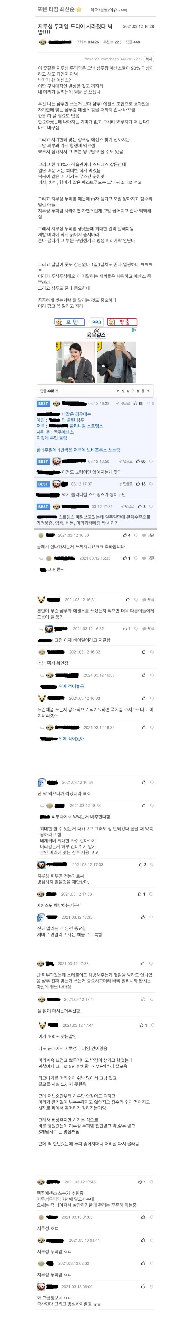  탈모까지 오는 '지루성 두피염' 퇴치하는 샴푸와 에센스 효과.JPG