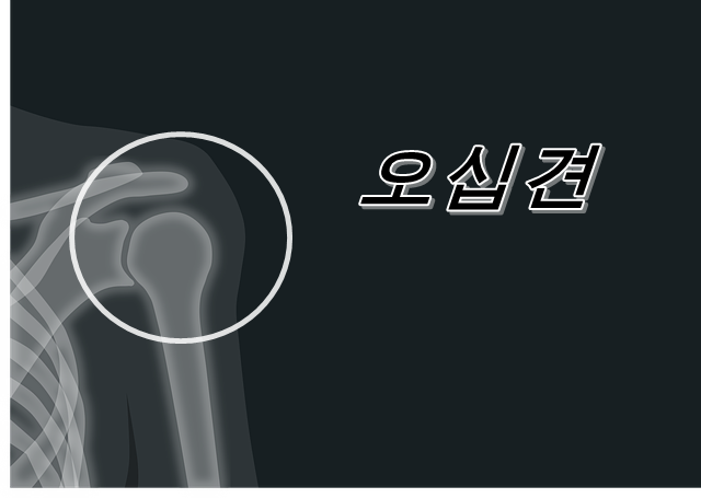  건판 파열과 40견(오십견)은 어떻게 다른가?