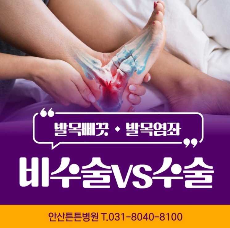  안산물리치료 발목염좌로 통증이 계속되면?
