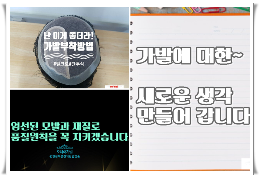  심는인모 맞춤가발 부착방법으로 많이 쓰이는  5가지가 이것입니다