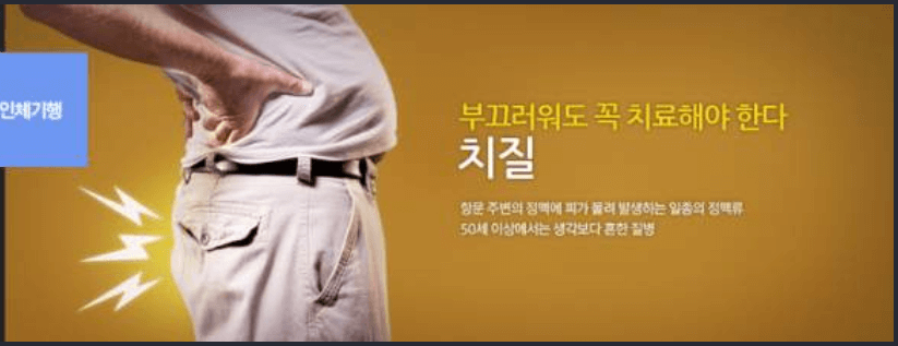 치질 유발 시키는 나쁜 습관이 있다? 예방 법 BEST7 알려드립니다.