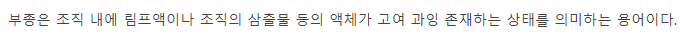  [취미] 건강관리_영원한 부종과의 싸움..!