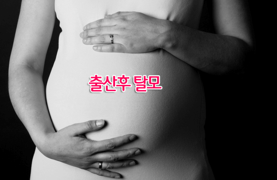  출산 후 탈모 어떻게 관리 해야 될까? 관리 및 예방 법 7가지 알려드립니다!