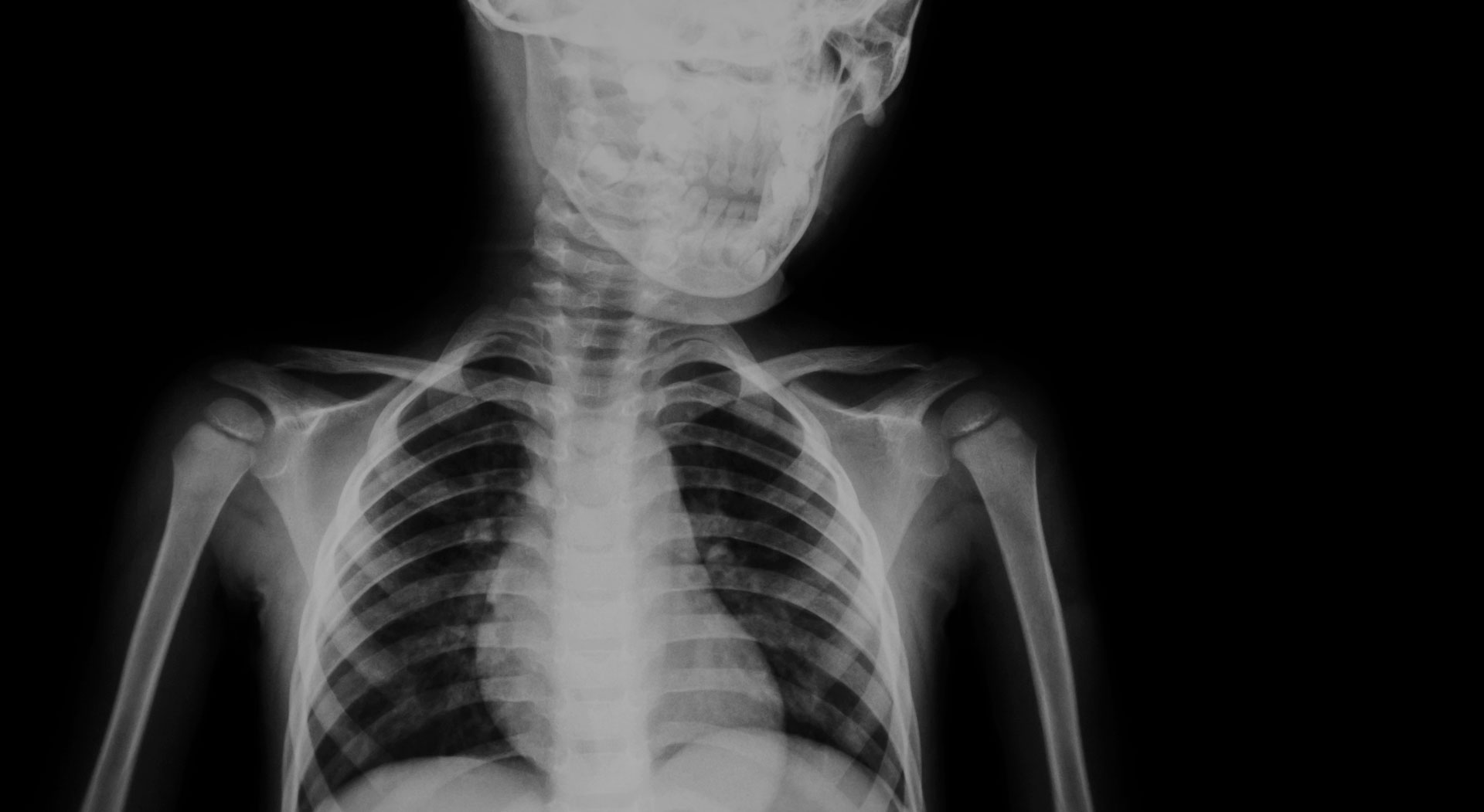  임신과 X-ray, 임신과 방사선 촬영에 대하여