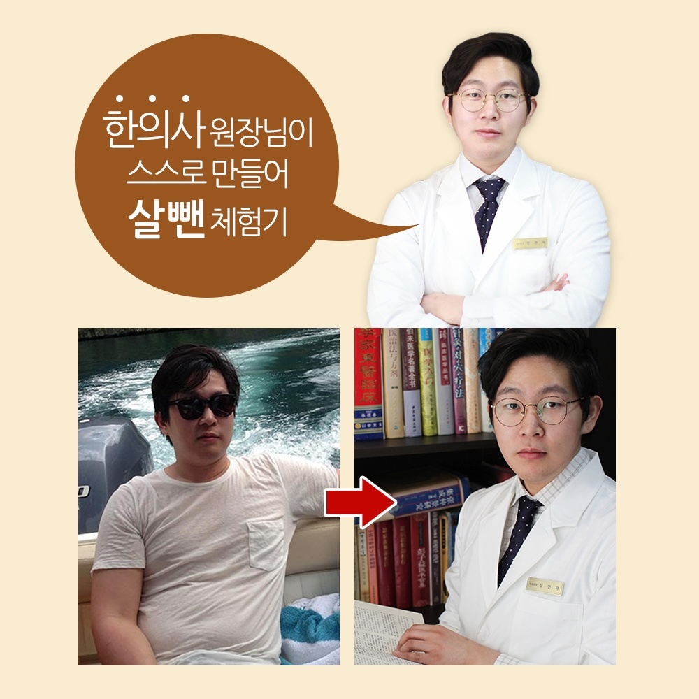  한약다이어트 한달 14kg 감량 기록한 공비환