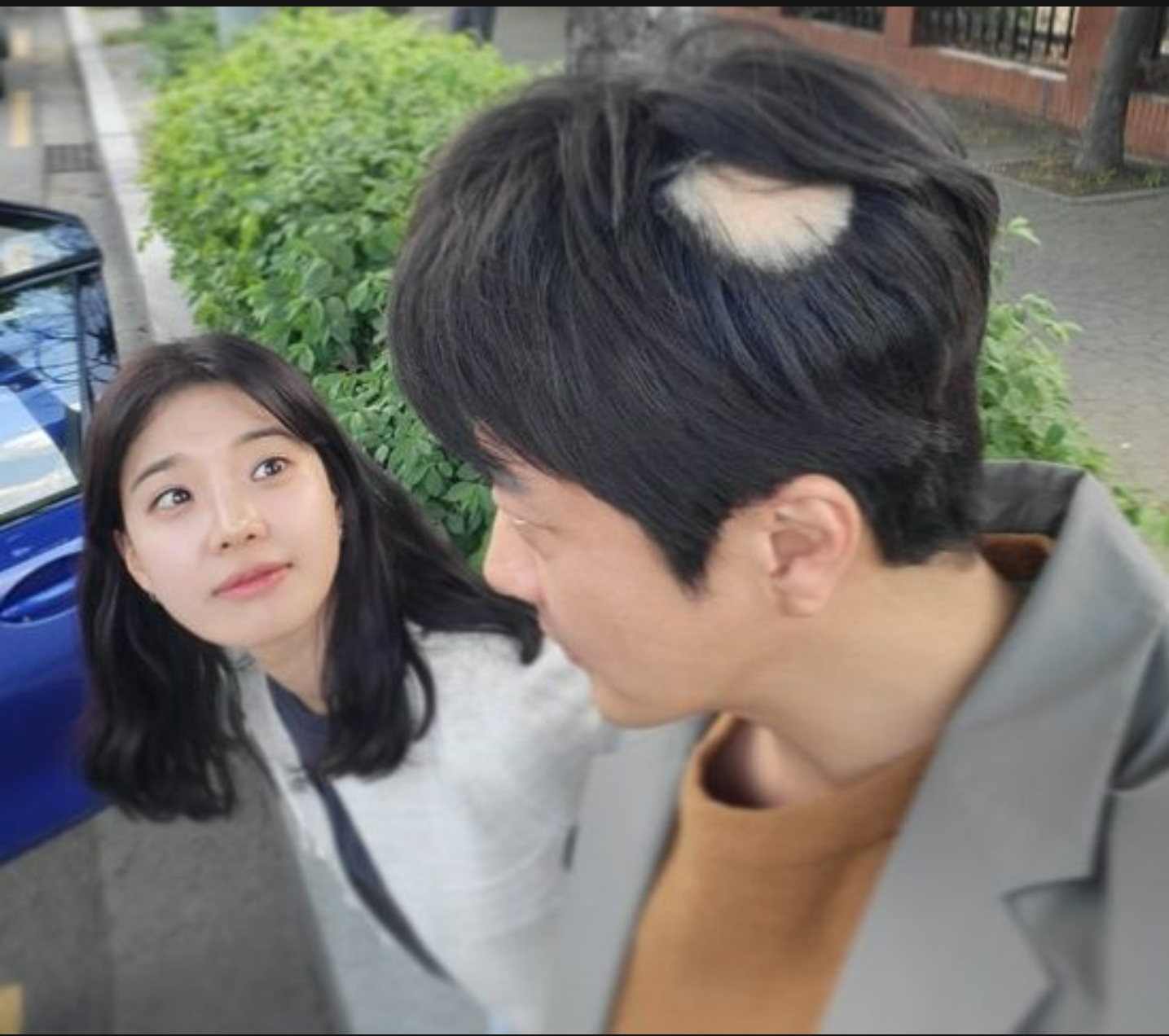  권상우, 원형 탈모 어쩌나…'손태영' 가슴 아프겠네