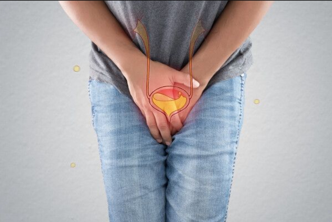  오줌 참기 어렵고 새버린다면?과활동 방광(過活動膀胱)