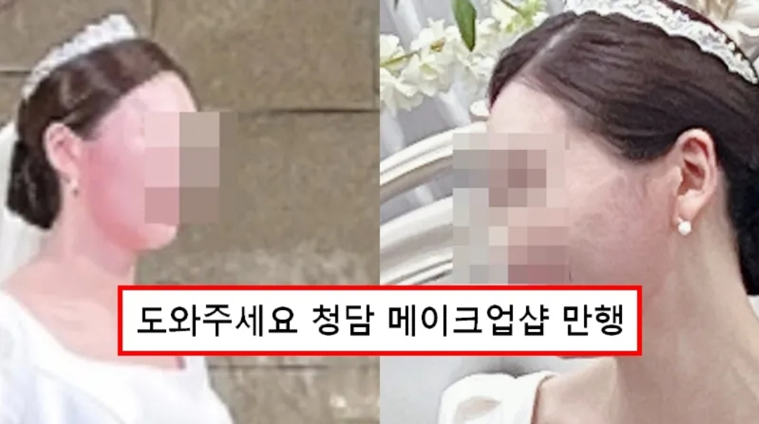  “한 번 뿐인 결혼식인데…” 청담동 메이크업숍 때문에 ‘빨간 얼굴’로 망신당한 새 신부