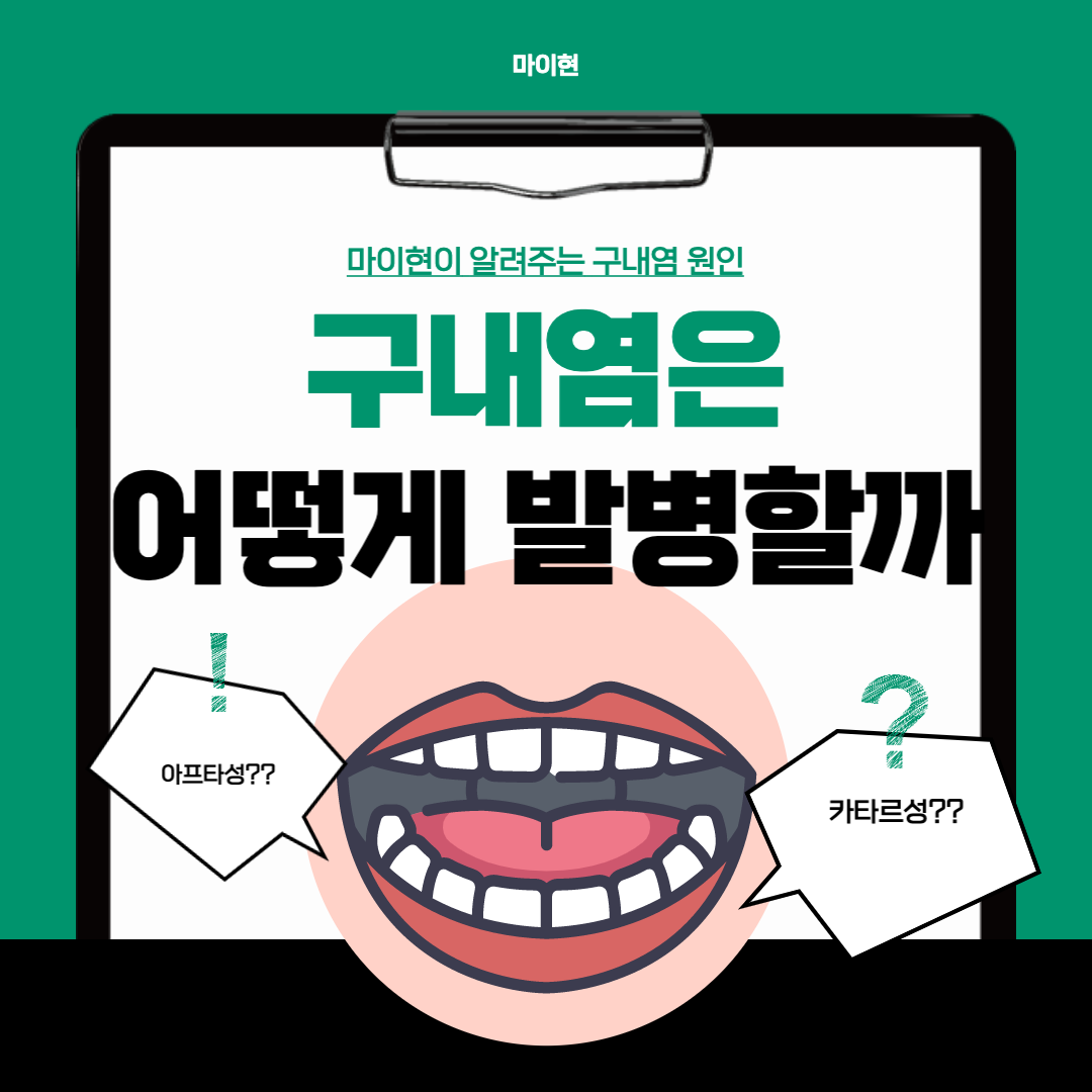  [구내염] 원인과 종류를 알아야 치료하기 쉽다