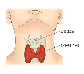  갑상선암 10명중 8명이 40대이상
