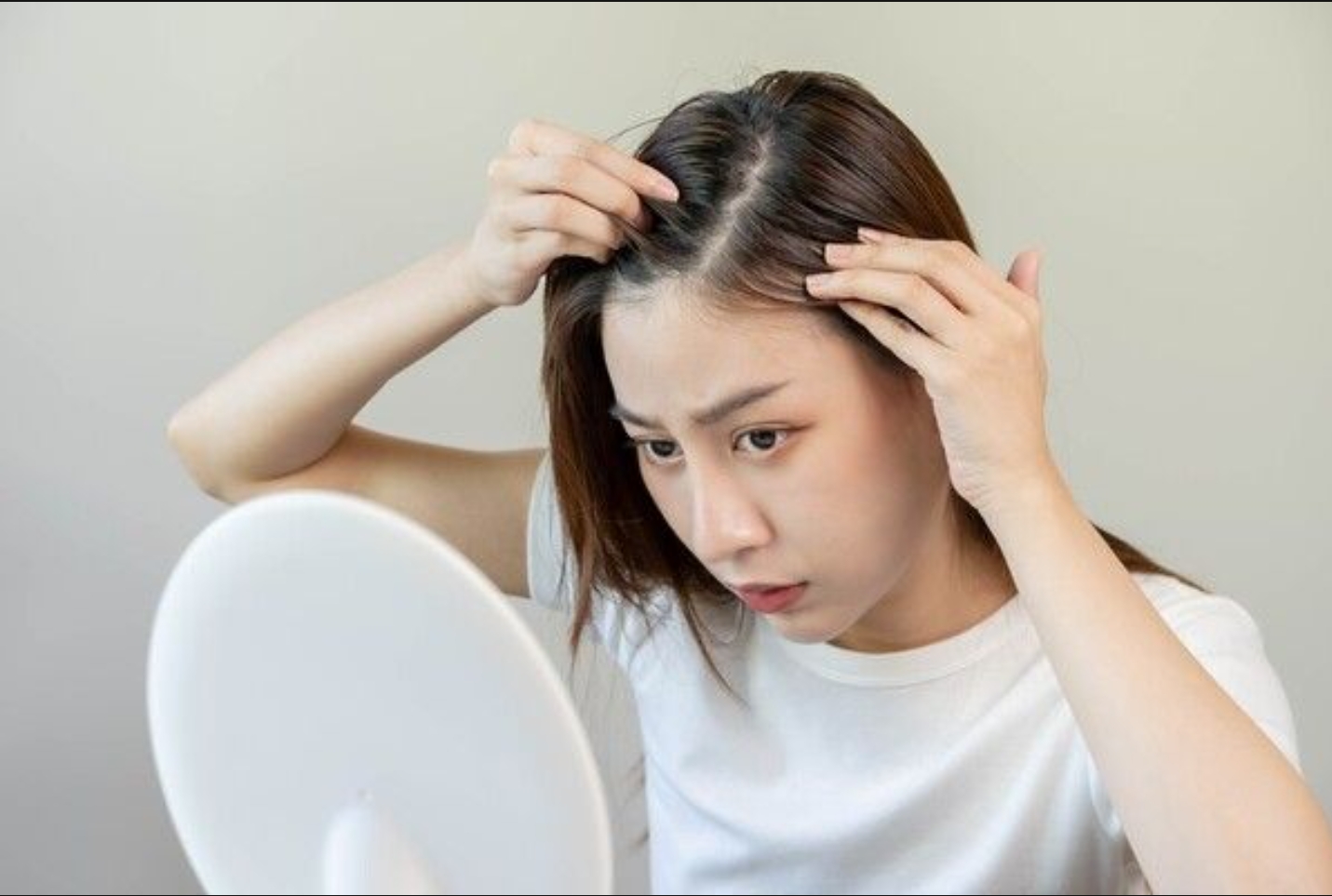  급격한 다이어트가 탈모 불러요!