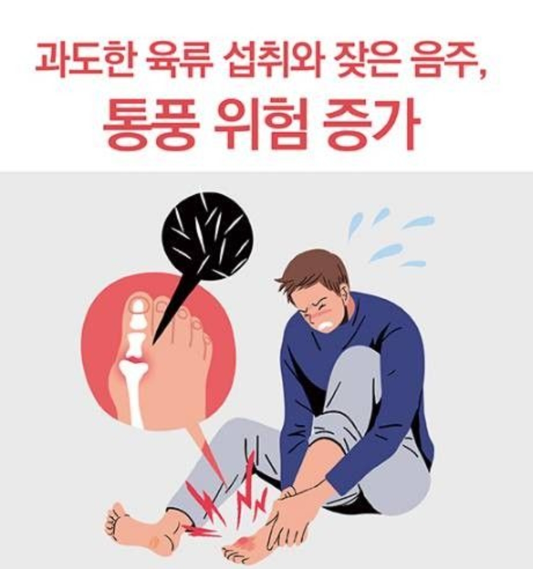  1일1닭' ' 단백질 열풍' 폭탄 터지나 - 통풍 환자 2배로 증가 , 대안은?⋯