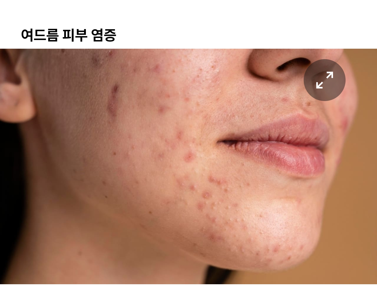  우유 섭취 줄이면 생기는 효과