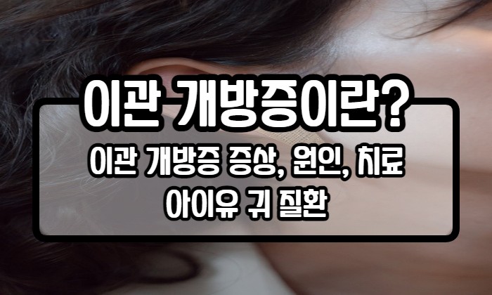  아이유 귀 질환? 이관 개방증이 뭐죠? 증상, 원인, 치료법까지