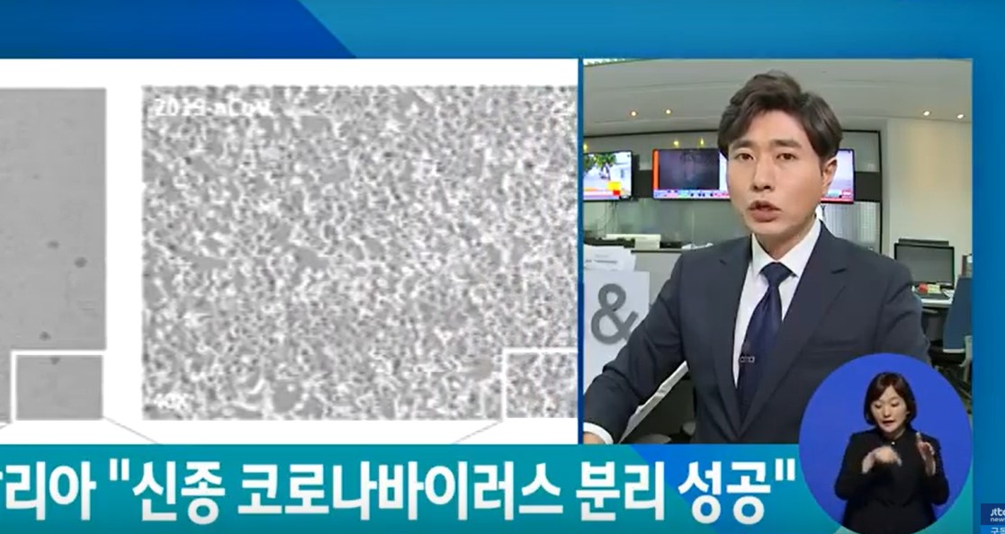  이탈리아 연구팀 신종 코로나 바이러스 분리 성공 - 공유 약속