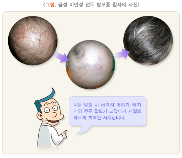  탈모 좋은 차가 있다? BEST 7 알려드립니다!