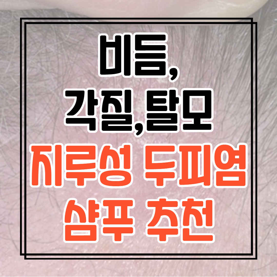  지루성 두피염 샴푸 추천 탈모, 비듬,각질 관리