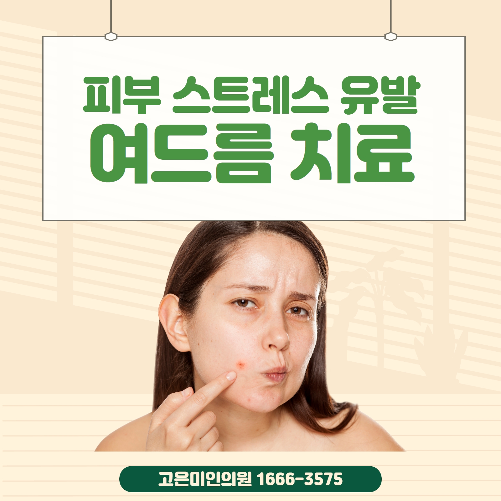  수원피부과에서 스트레스 유발하는 여드름 해소하는 방법!