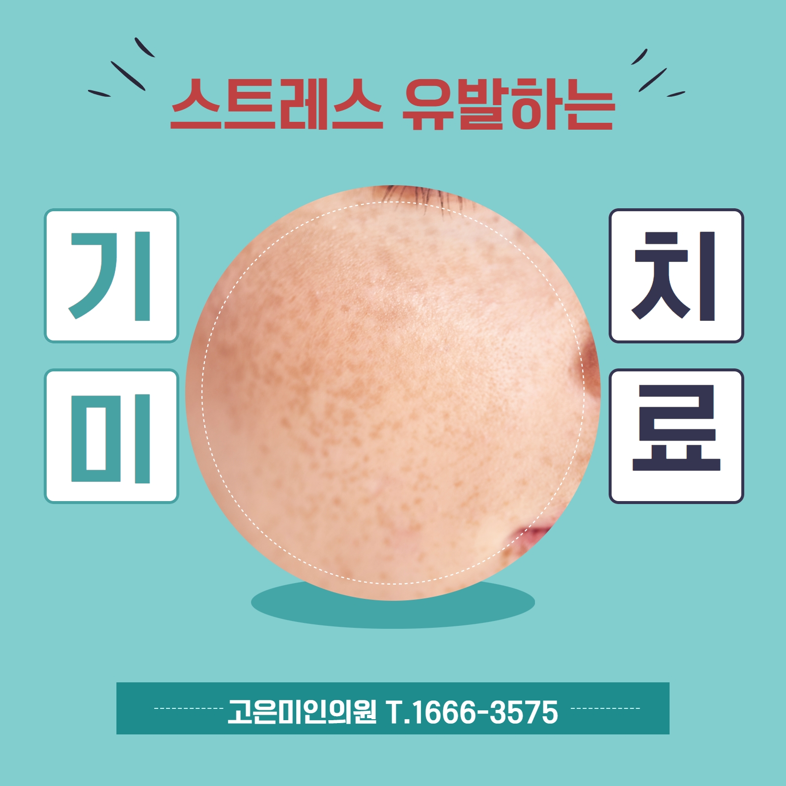  수원기미치료 스트레스 유발하는 '기미' 치료법은?