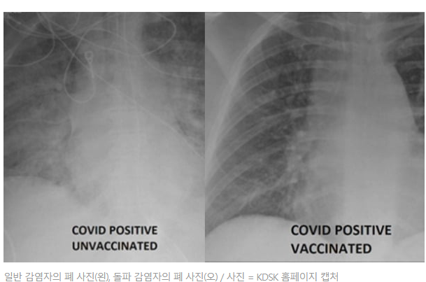  병상부족위기, 코로나 자가 관리를 위한 응급용 산소호흡기
