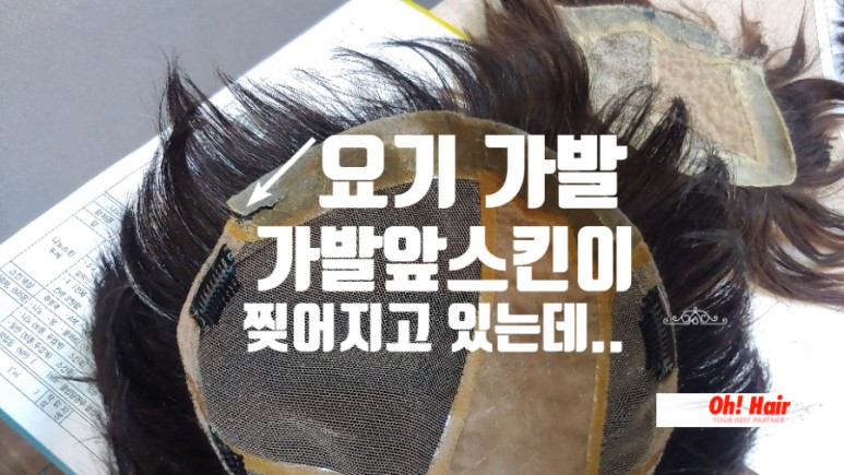  맞춤가발수선 수리 '걱정하지마세요! 앞스킨찢어짐 수선으로 고민끝!'