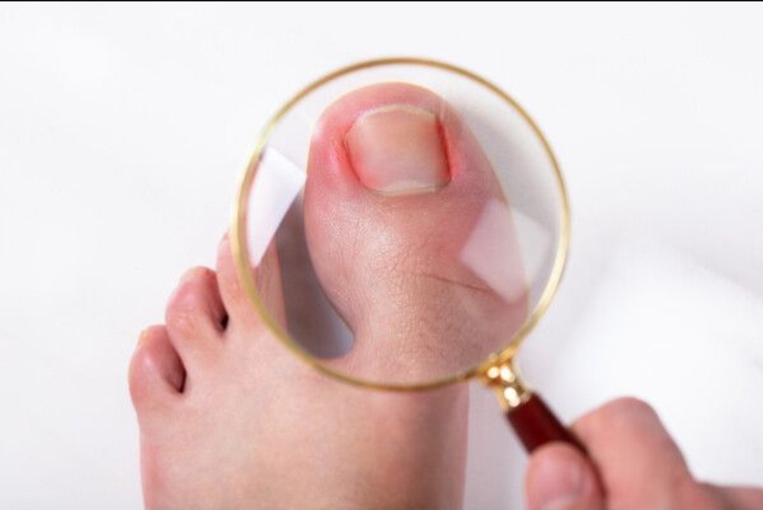  발톱 색깔 변하거나 뭐 생겼나요?