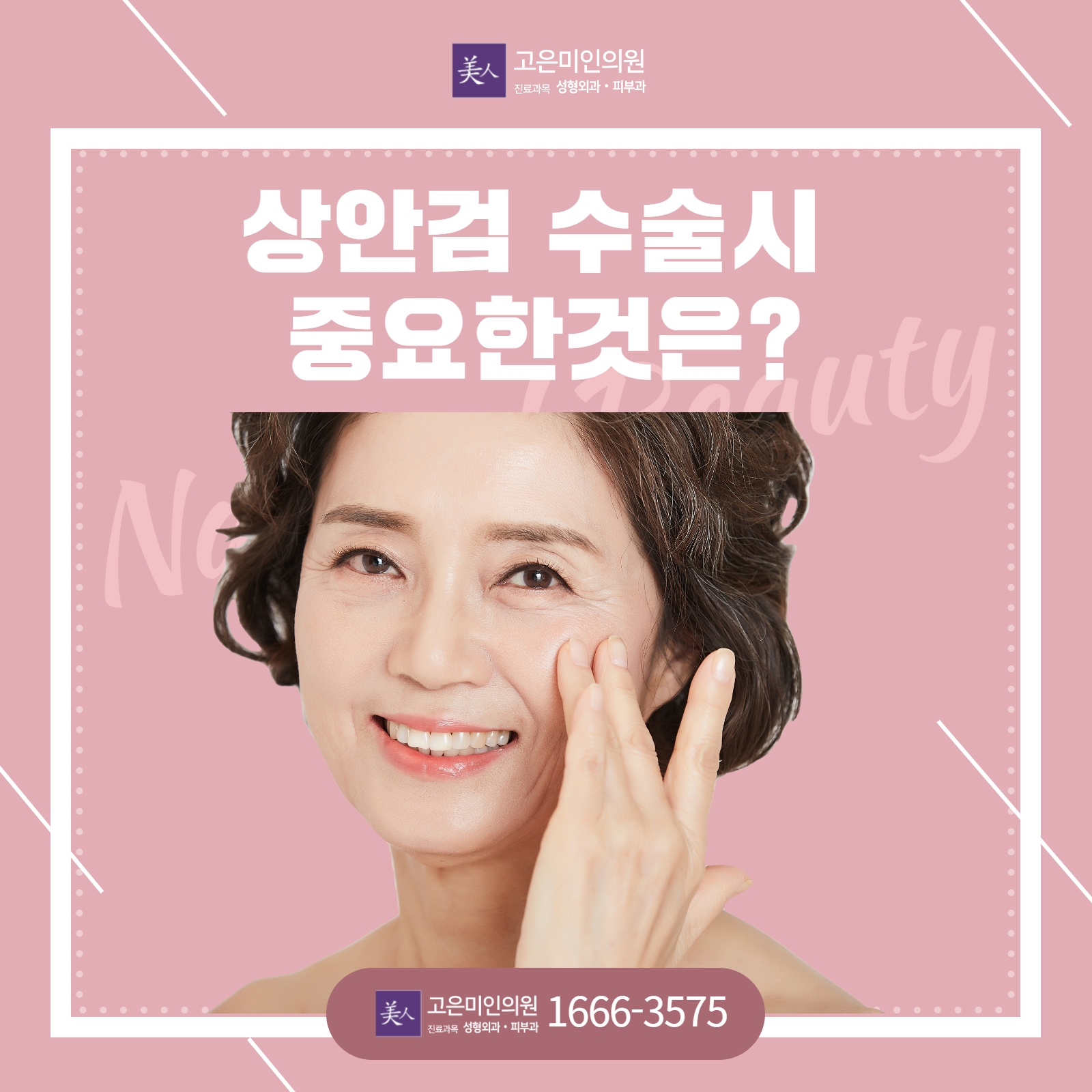  수원상안검수술시 중요한것은?