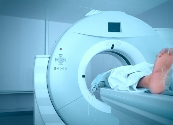  검진때 하고 진료 때 또 찍고…암 찾으려 CT 찍어대다 암 걸릴라 ...