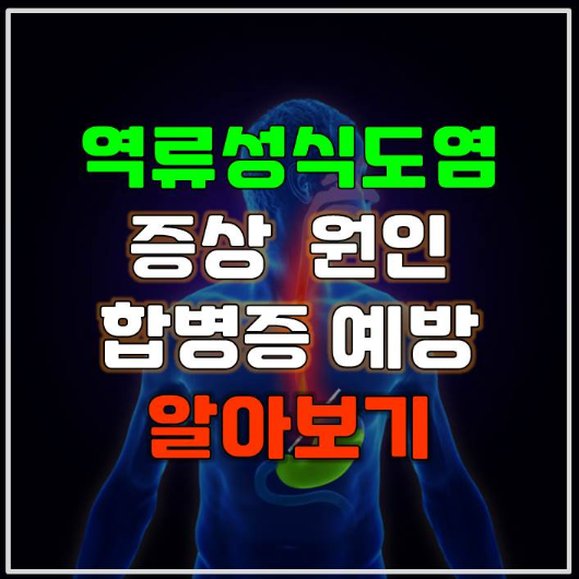  역류성 식도염 증상 원인 치료 합병증 예방 알아보기