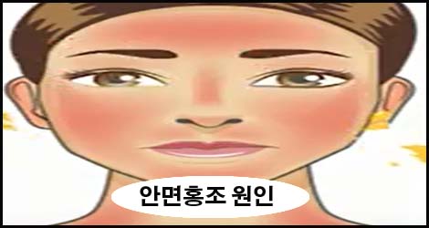  겨울철 심해지는 안면홍조 원인과 예방법
