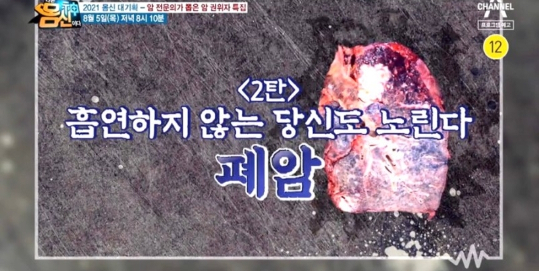  나는몸신이다 폐암증상 암명의가뽑은명의의사 폐식도외과김형렬교수 폐암완치율높이는솔루션343회0805