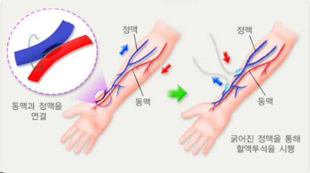 센시아 복용 효과