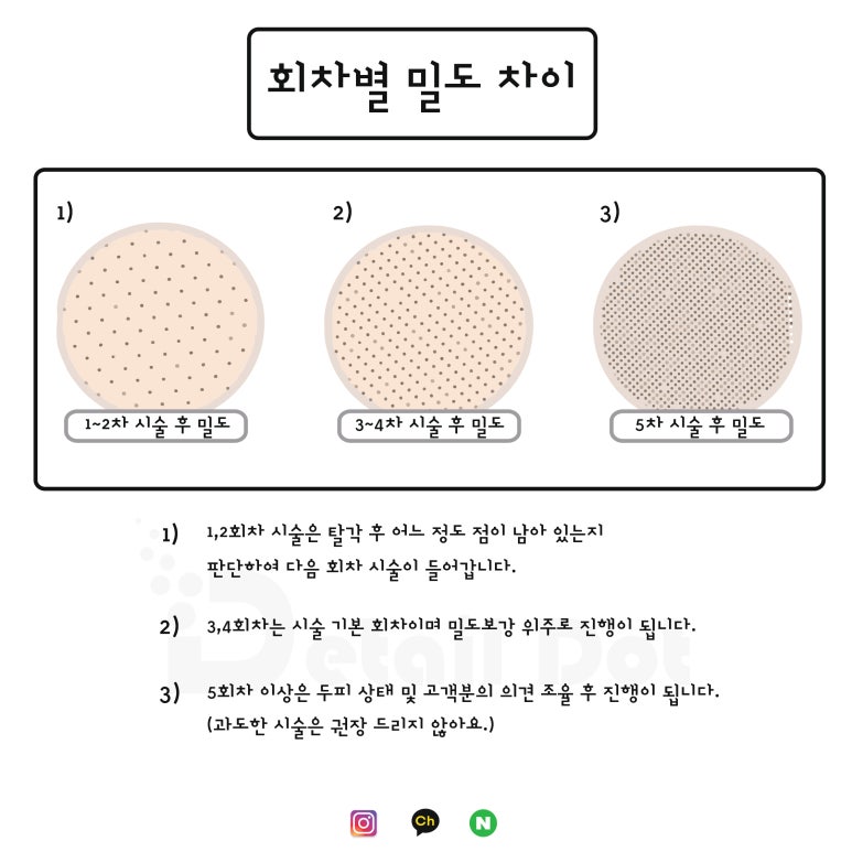 대구두피문신 smp 회차별 밀도 차이