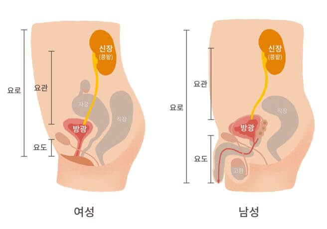 방광염 증상