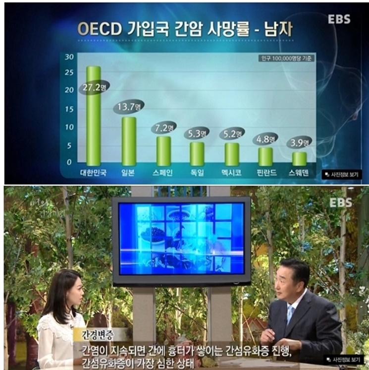  간에 좋은 음식 및 간에 안좋은 음식