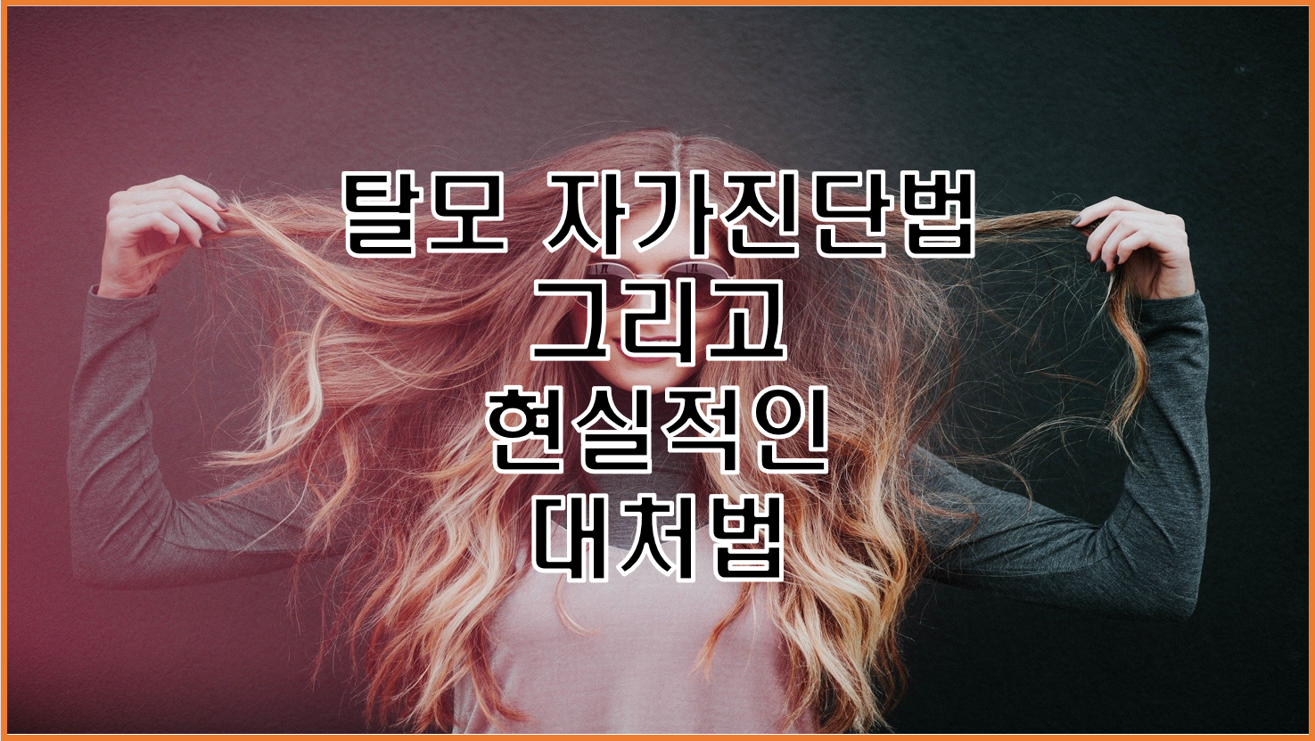  탈모 원인과 종류 치료 그리고 자가진단법과 현실적인 예방 방법