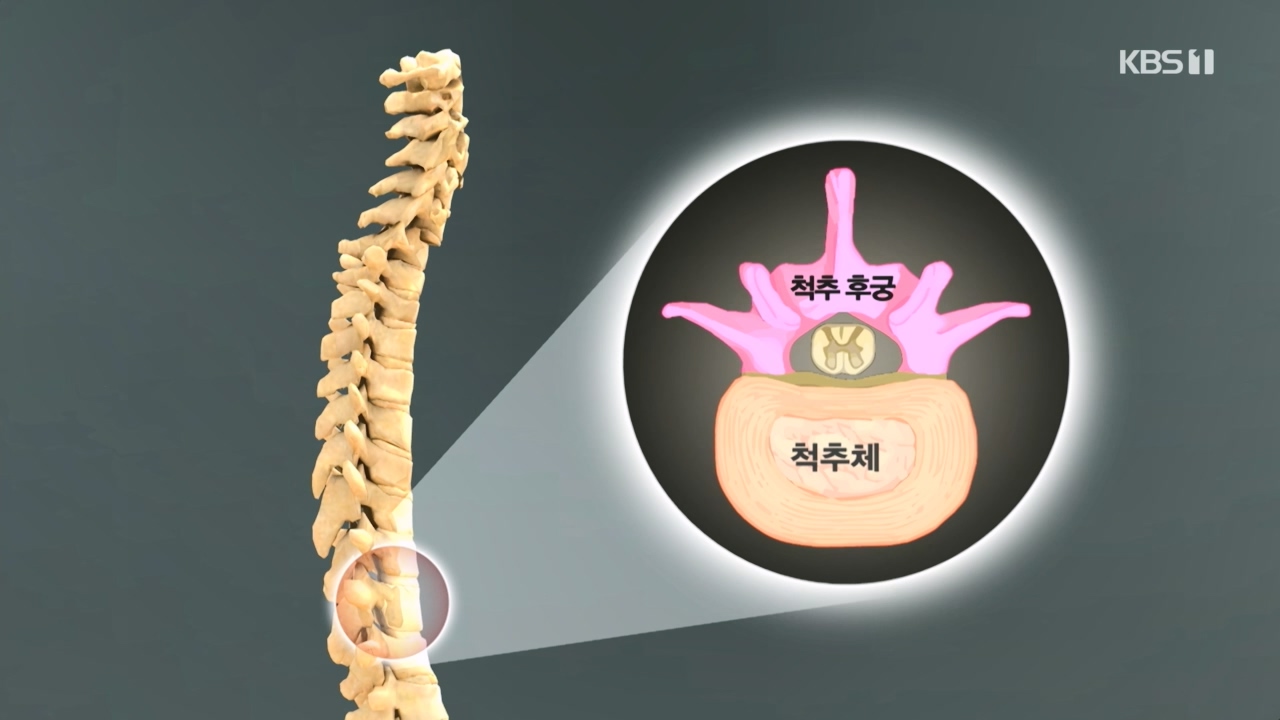 생로병사의 비밀.E866.230427p.H264-F1RST.mp4_20230427_202700.267.jpg