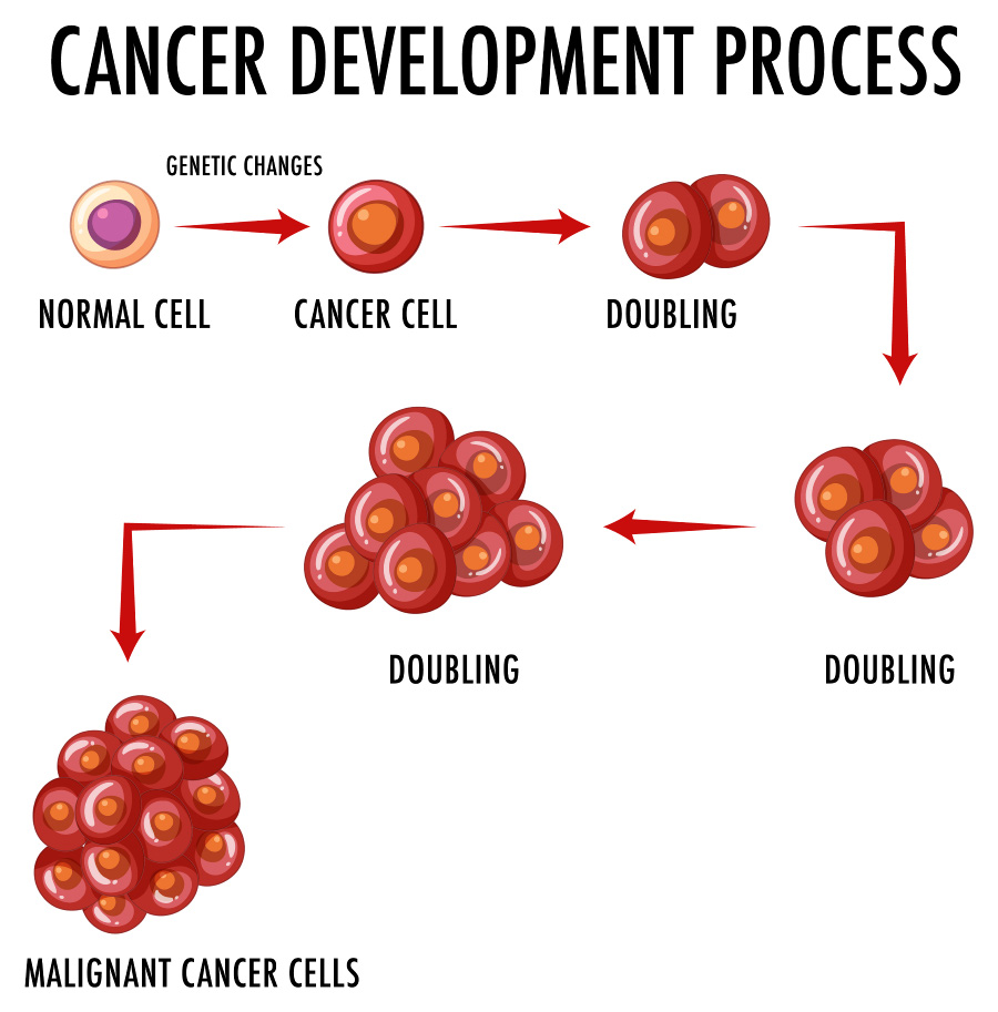 정상적인 세포가 암세포로 전이가 되어서 점점 커져가는 과정을 이미지화를 한 사진