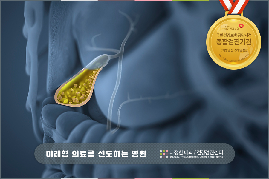 쓸개 담석 제거 방법 쓸개에 담석이