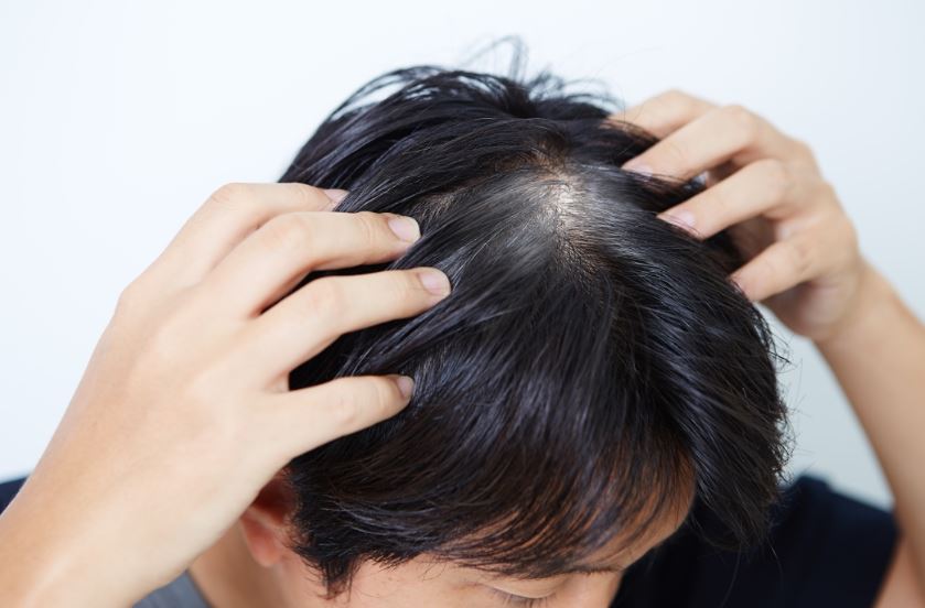 흰머리 뽑으면 안되는 이유..새치 뽑으면 더난다?