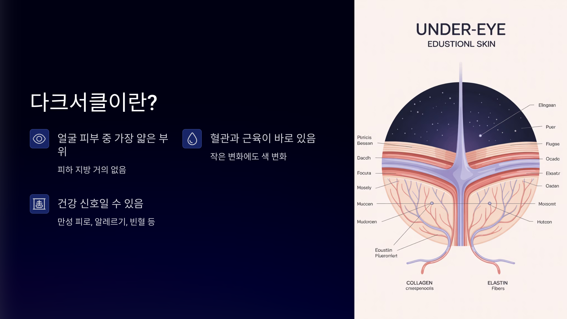 다크서클이란?