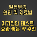  발톱무좀 원인 및 치료법 자가진단 테스트 효과 좋은 약 추천