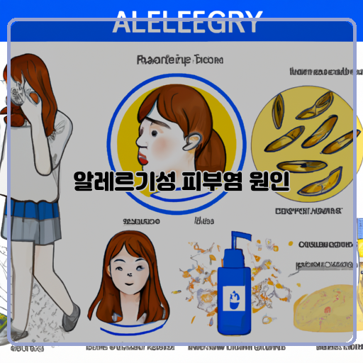 알레르기-피부염-예방-방법