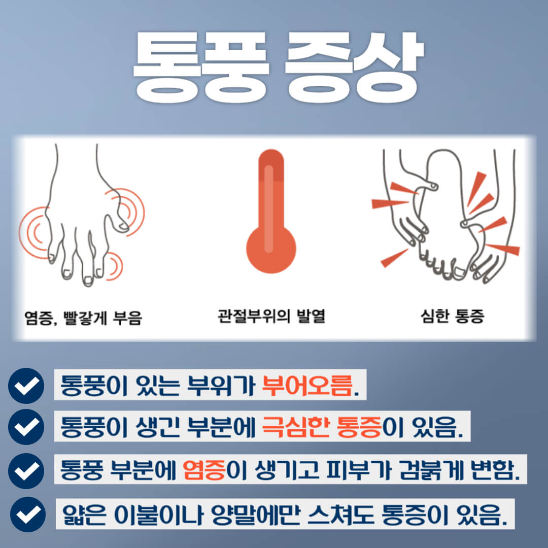 통풍 증상