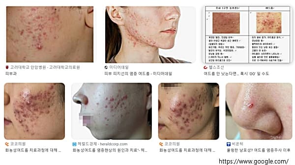 경기도 가평군 토요일 피부과 진료 병원 치료