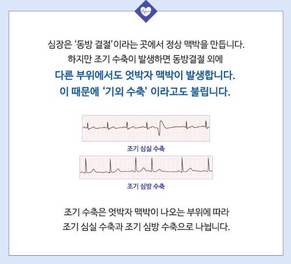 부정맥