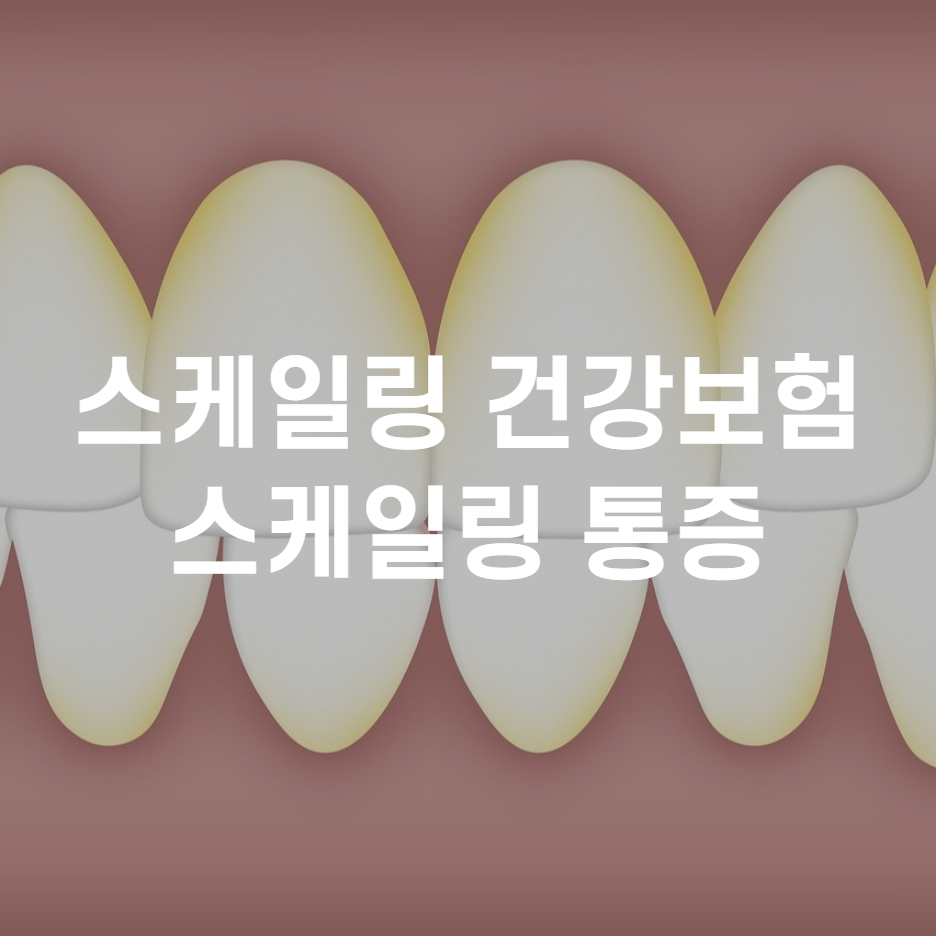  치과 스케일링 아픈가요? 건강보험 적용 되나요?