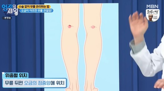 위중혈
